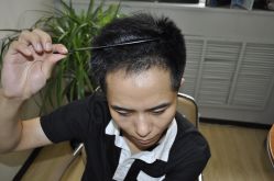 -大麦微针植发丨全国连锁