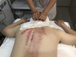 -镜面皮肤管理