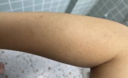 -顺德壹加壹美容医院