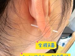 -杭州市第三人民医院