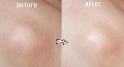 -SKINIST丽铂医疗美容