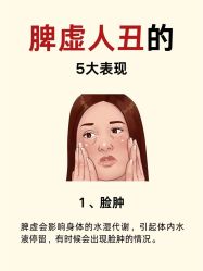 -克丽缇娜