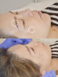 -清疣美疣·痣·斑净肤中心
