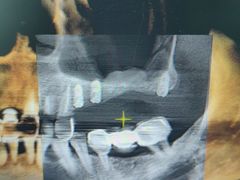 -同步齿科·数字化正畸种植口腔中心(珠海店)