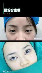 -郡艺医疗美容·微整·眼鼻吸脂