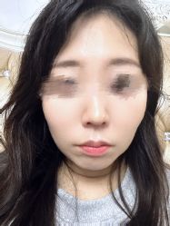 体验后-南京医科大学友谊整形外科医院