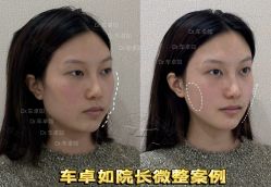 -Yestar重庆艺星医疗美容医院