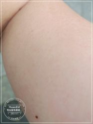 -MUSES专业高端脱毛日式比基尼サロン连锁