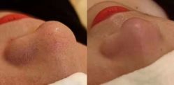 -苑苑vbeauty科技美容SPA
