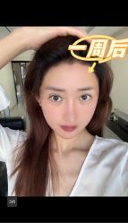 -雍禾植发全国连锁