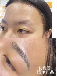 体验前-重庆联合丽格第五医疗美容医院