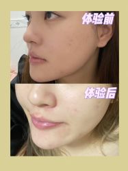 -深圳艺星医疗美容医院