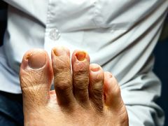 -新甲连锁灰指甲·甲沟炎·鸡眼(黑龙江路店)