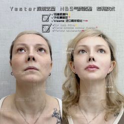 -深圳艺星医疗美容医院