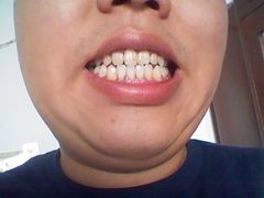 -天津市第三中心医院