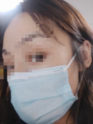 -More摩尔医美の注射线雕光电中心