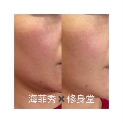 -Fundi张玉珊修身堂·indiba·BTL科技瘦身