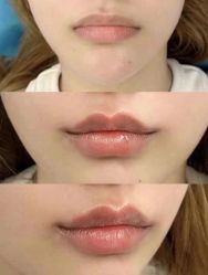 -尊尚柏丽美容SPA