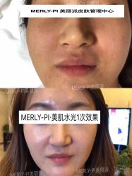 -MLP美丽派·问题肌疗愈中心