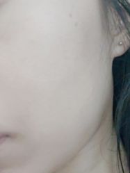 体验前-东剑医学美容·注射美学中心