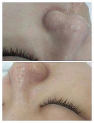 -美肤盾祛痘·问题肌头疗管理中心