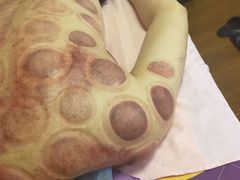 -沈师傅盲人按摩工作室(密三小区店)
