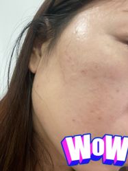 体验前-来美轻医美抗衰中心