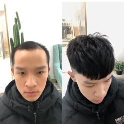 -发饰美男士增发补发假发定制店