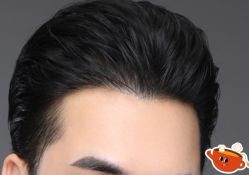 -大麦微针植发丨全国连锁