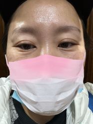 体验后-金圣医疗美容