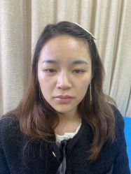 点击看大图 体验前-重庆联合丽格第五医疗美容医院