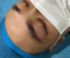 体验后-重庆军科整形美容医院