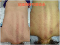 -丽减美瘦吧·减肥瘦身