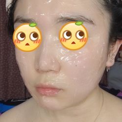 体验后-西安现代妇产医院医疗美容