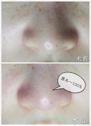 水氧-光SPA科技美肤