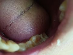 -首都医科大学附属北京友谊医院(西城院区)