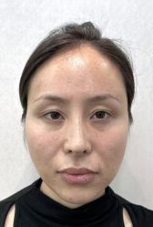 -广州曙光医学美容医院