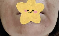 -上海玫瑰医疗美容医院