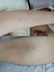 -中科妍美专业脱毛美肤连锁机构