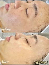-SKIN79皮肤管理中心