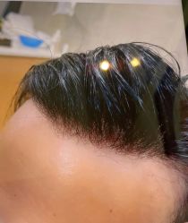 -唐风采假发补发定制