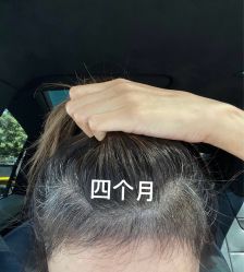 -熙朵美学植发·连锁品牌