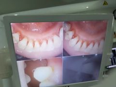 -土豆口腔(凤凰北总店)