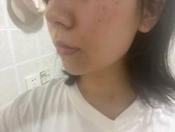 体验后-重庆军科整形美容医院