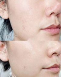 -SKINIST丽铂医疗美容