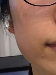 -宁波美莱整形美容