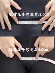 -梦斯绮私密催乳修复中心