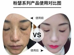 -仙海旅游度假区