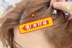 -大麦微针植发全国连锁