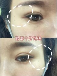 -八大处整形
